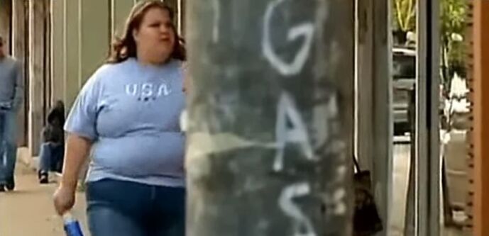 Excess weight the cause of varicose veins