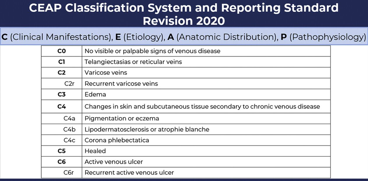 Stages of varicose veins according to the CEAP classification modified in 2020